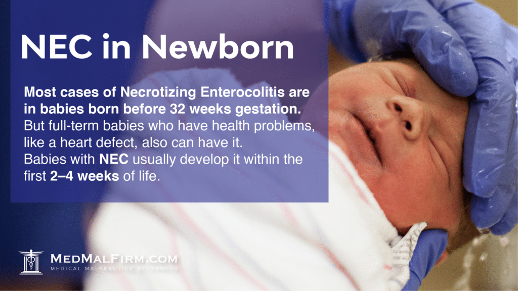 NEC in Newborns | MedMalFirm.com