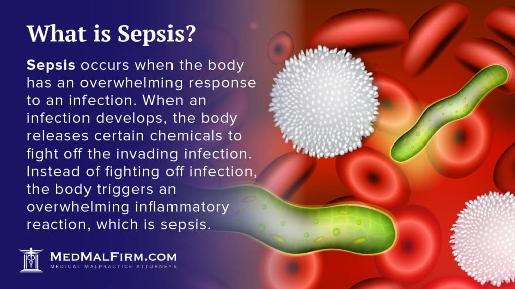 Sepsis | MedMalFirm.com